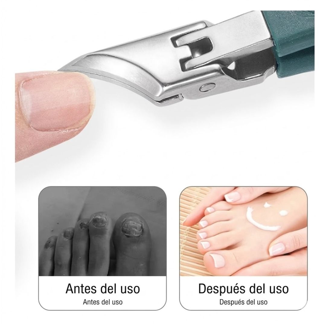 Corta Uñas de Esquina: Sin dolor por uñas encarnadas