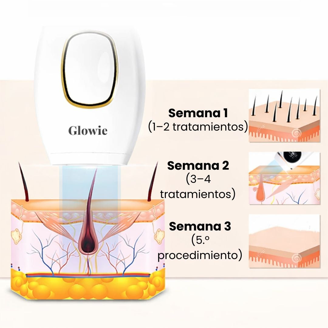 DEPILADORA LASER