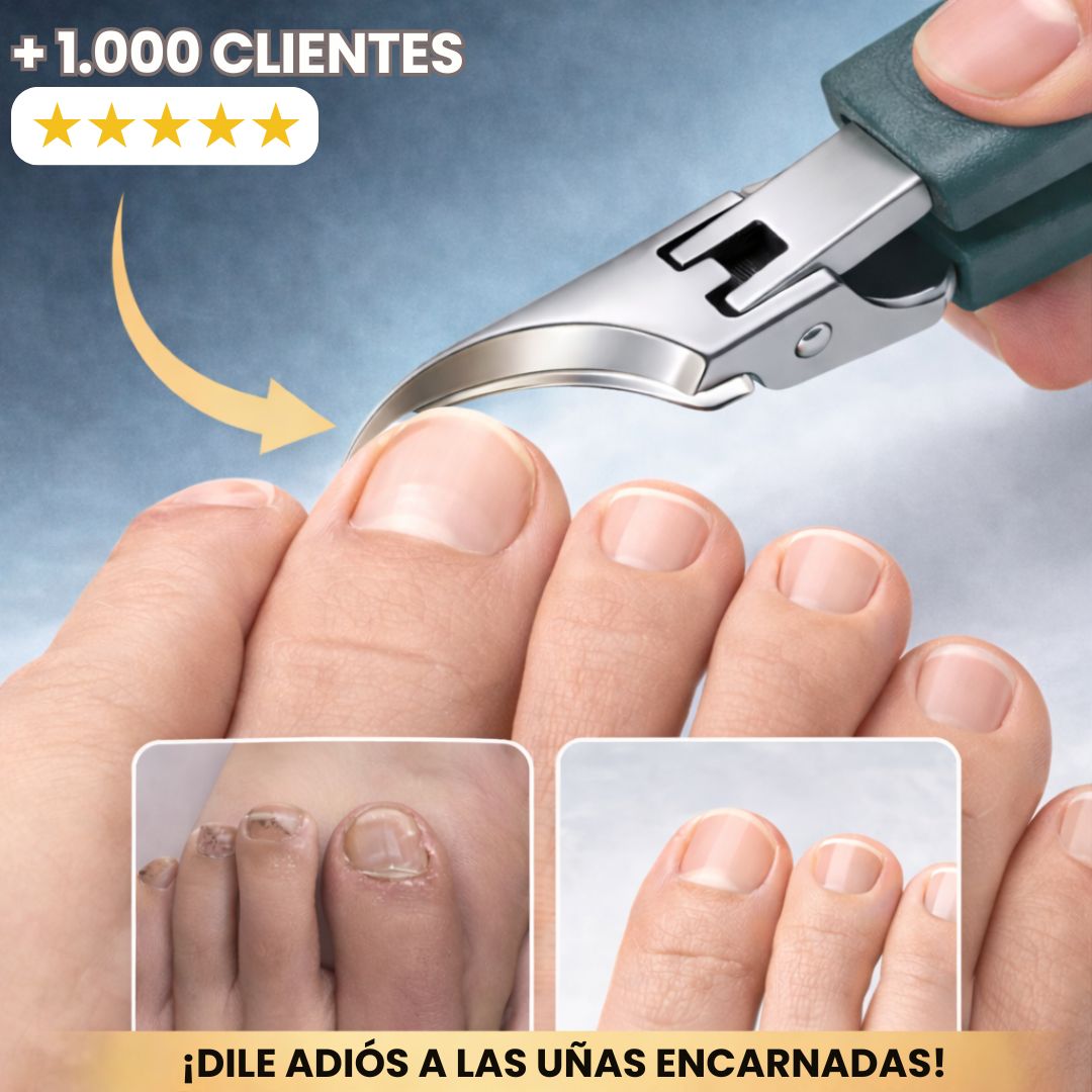 Corta Uñas de Esquina: Sin dolor por uñas encarnadas