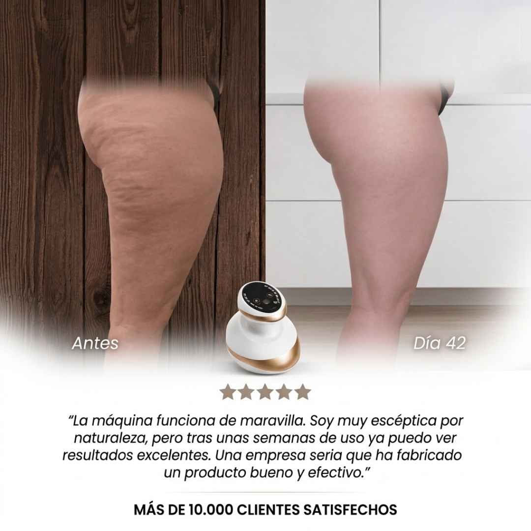 Masajeador Ventosa para Celulitis: Siente Alivio y Nota La Diferencia