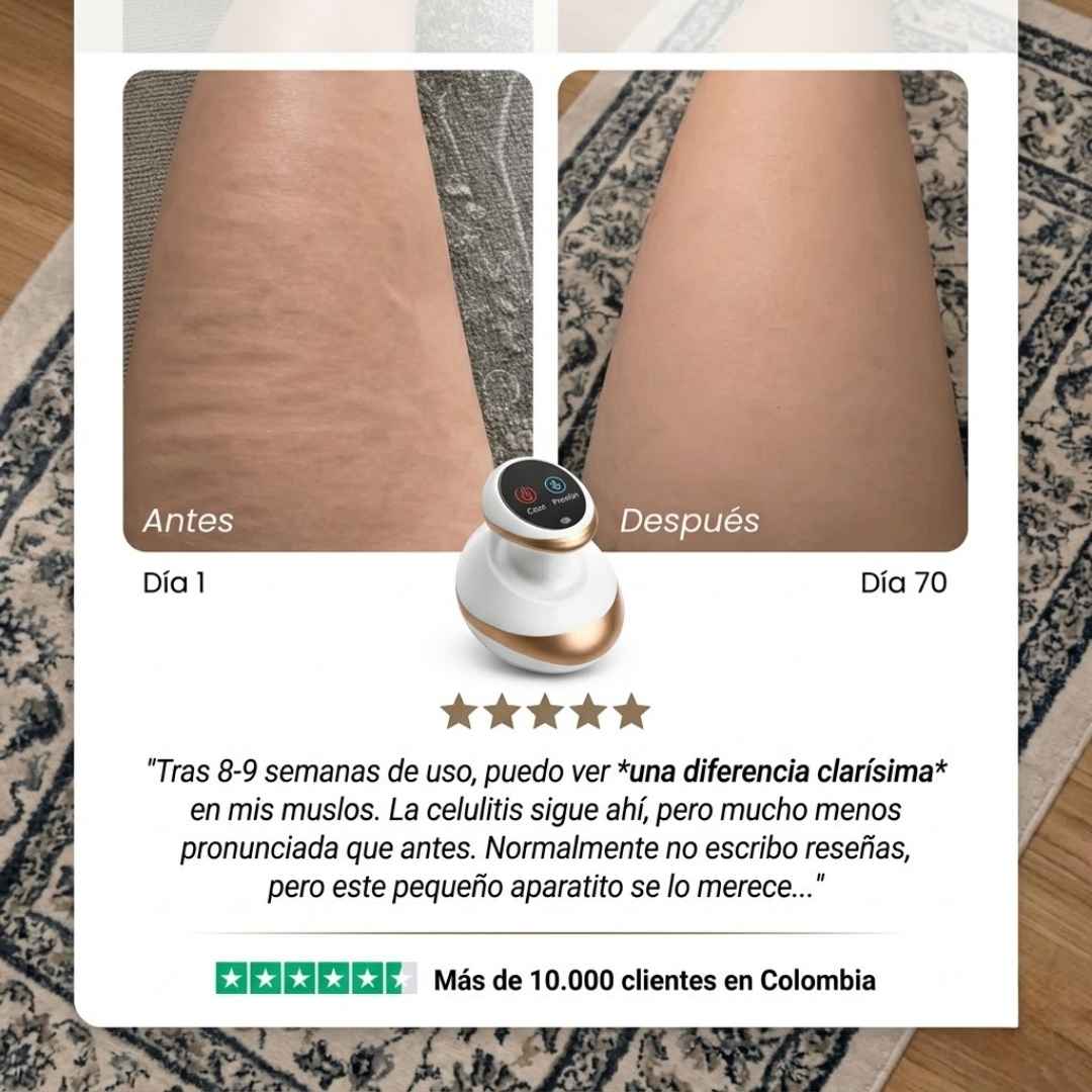 Masajeador Ventosa para Celulitis: Siente Alivio y Nota La Diferencia