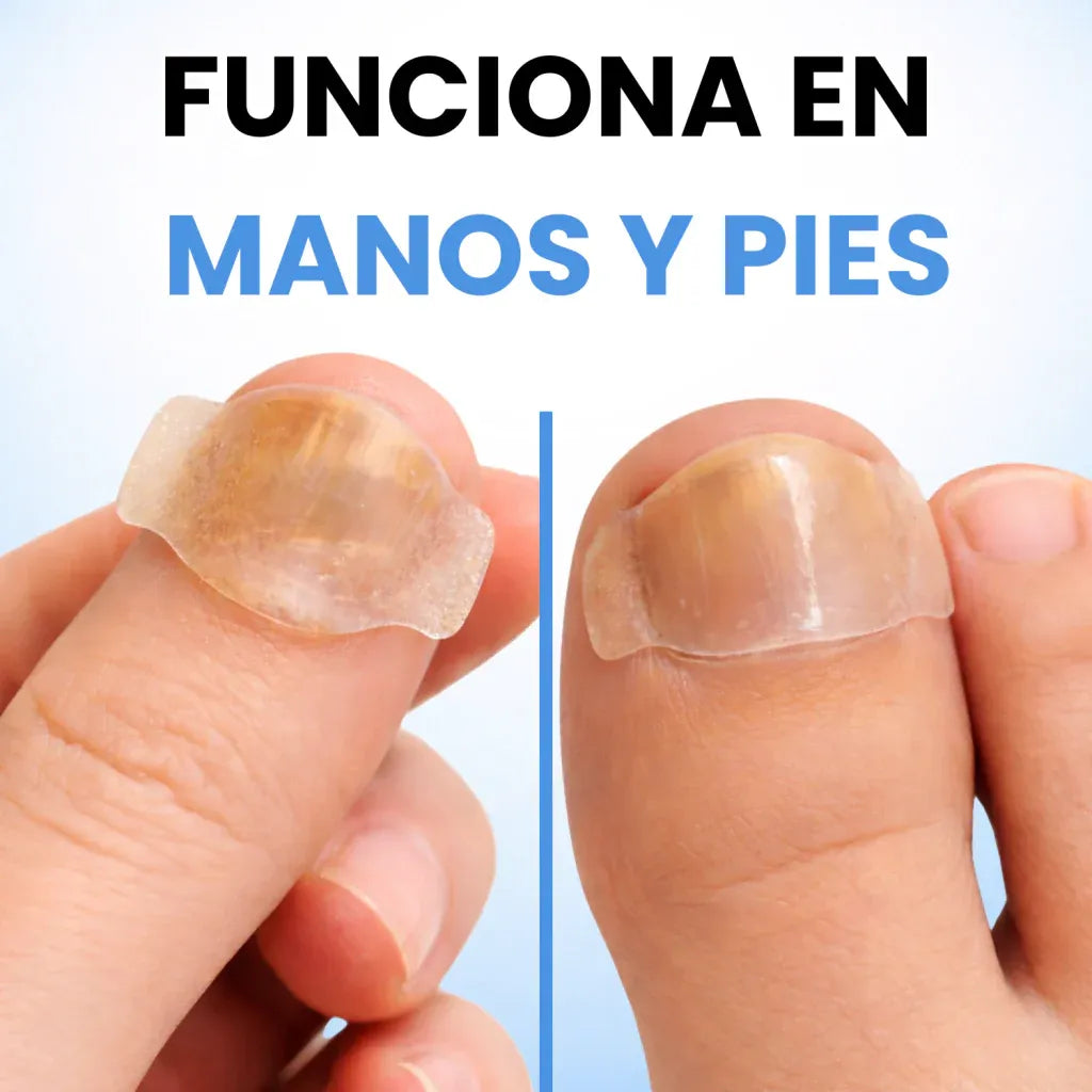 PARCHES ANTIHONGOS PARA UÑAS- SIENTE CONFIANZA TOTAL